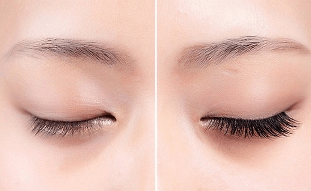 Cắt mí bao lâu thì được nối mi?
