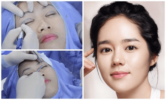 Dùng kem trị sẹo đúng cách