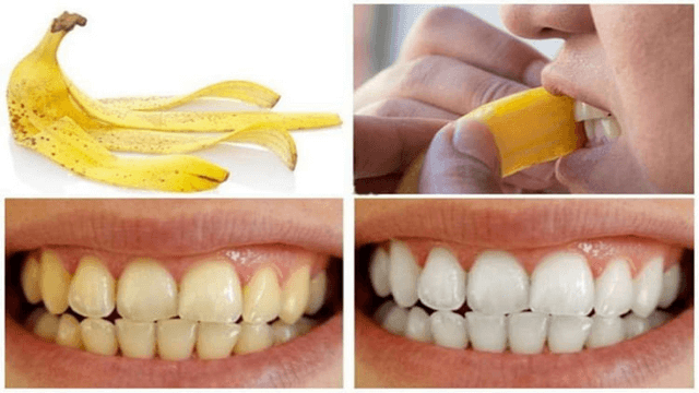 Cách bảo vệ sức khỏe răng miệng