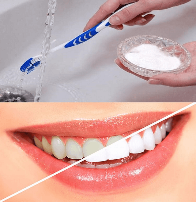 Công thức làm trắng răng tại nhà với muối