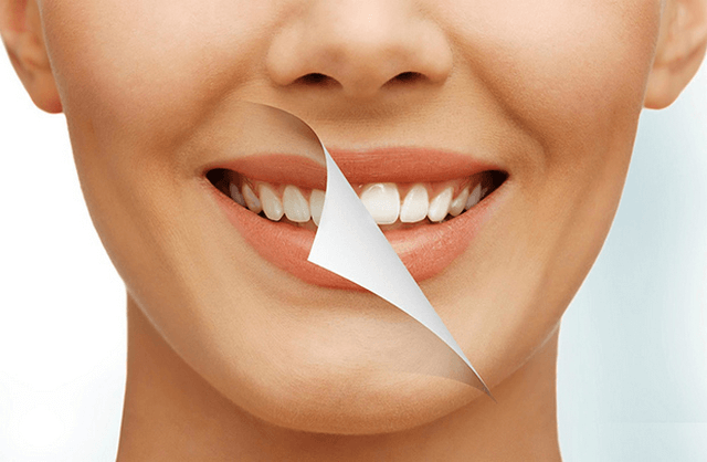 Cách làm trắng răng bằng dầu dừa