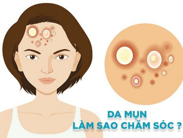 Những ai nên tẩy tế bào chết?