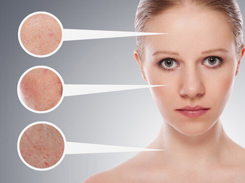 Chỉ vàng!!! Chiếc đũa thần xua tan lão hóa da 4 1726654402 119 Meo cham soc da mua he dung cach cho nam