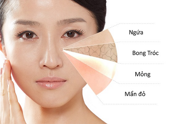 Dưỡng ẩm là cách làm da mặt mịn màng dễ thực hiện nhất