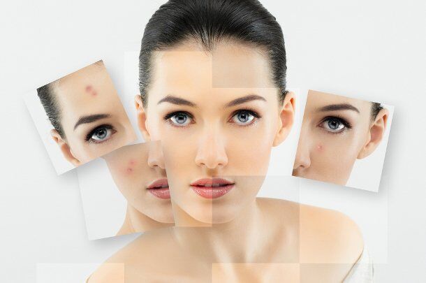 1726659696 938 Cach cham soc da sau khi ban laser tai nha