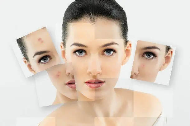 1726659696 938 Cach cham soc da sau khi ban laser tai nha