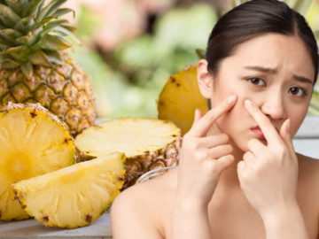 Phương Pháp Trị Mụn Cóc Hữu Hiệu