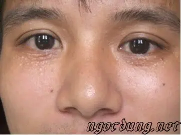 4 luu y ve mun thit ban can nho