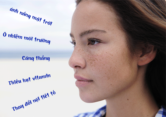 tư vấn điều trị nám