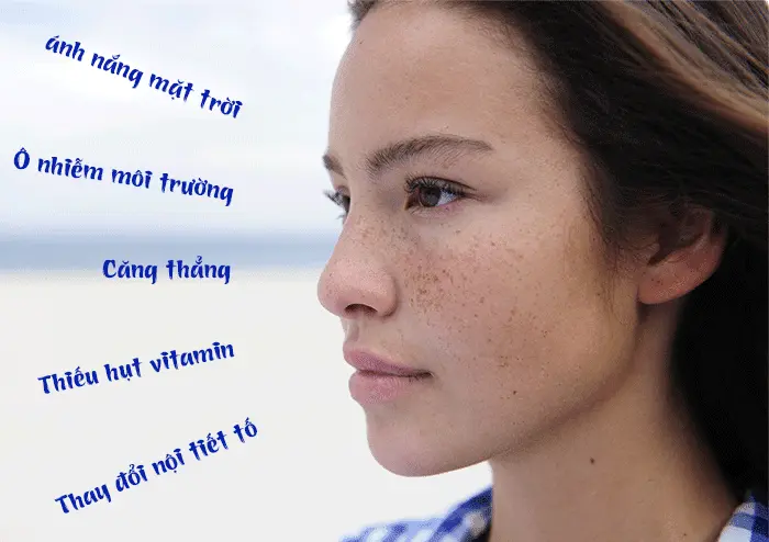 tư vấn điều trị nám