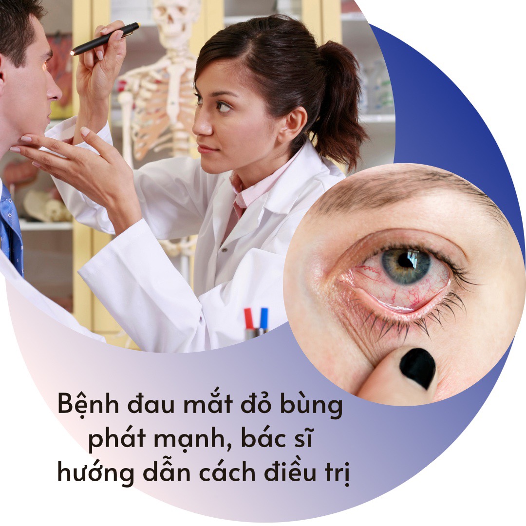 Đau mắt đỏ có lây không - tham khảo nhé