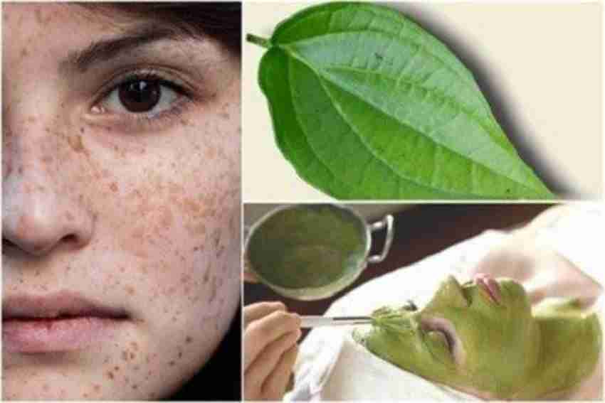 Cách Trị Nám Da Mặt Tại Nhà Từ Nguyên Liệu Thiên Nhiên