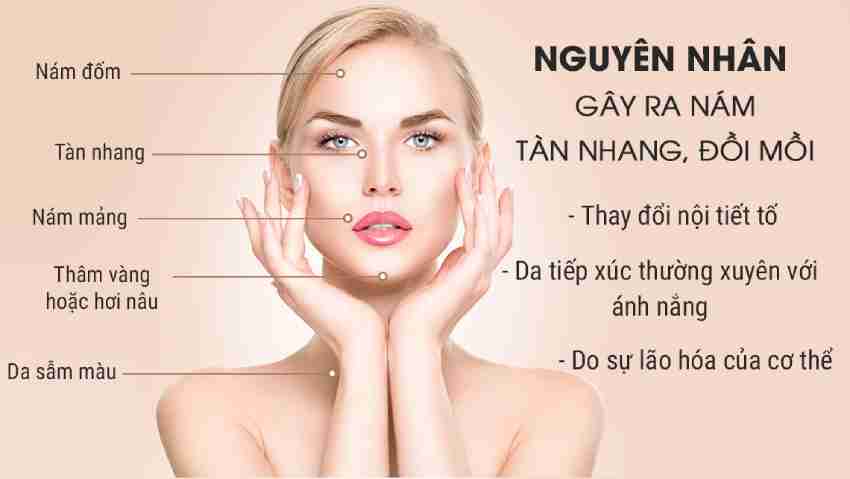 Cách Trị Nám Da Mặt Tại Nhà Từ Nguyên Liệu Thiên Nhiên