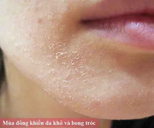 Da kho Con ac mong cho phu nu vao