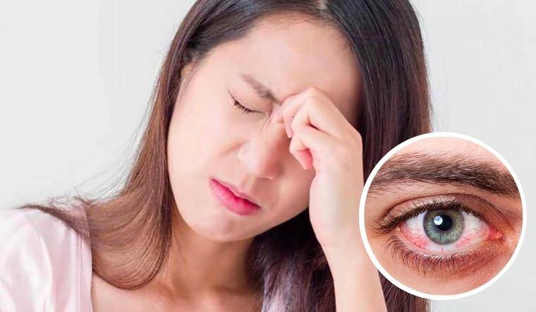 Đau mắt đỏ có lây không - tham khảo nhé