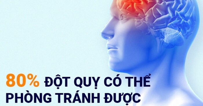 Đột quỵ một vấn đề cấp bách chúng ta cần quan tâm 14 Đột quỵ một vấn đề cấp bách chúng ta cần quan tâm
