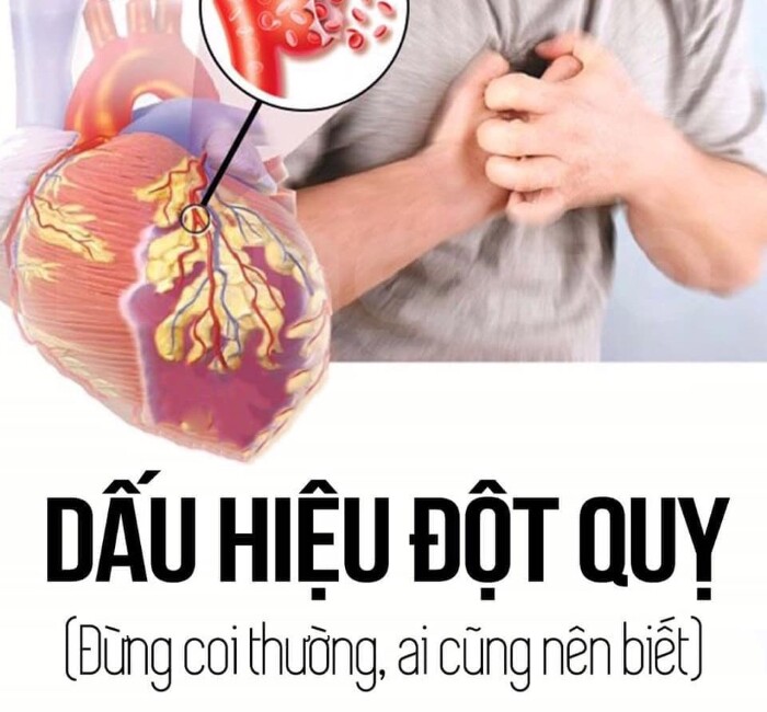 Đột quỵ một vấn đề cấp bách chúng ta cần quan tâm 4 Đột quỵ một vấn đề cấp bách chúng ta cần quan tâm