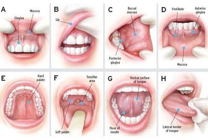 Top những loại thuốc trị nhiệt miệng hiệu quả nhất hiện nay 2 Top Những Loại Thuốc Trị Nhiệt Miệng Hiệu Quả Nhất Hiện Nay