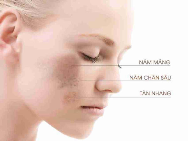 Vài cách chống nắng để ra đường khỏi bị nám dành cho chị em 2 Vài cách chống nắng để ra đường khỏi bị nám dành cho chị em