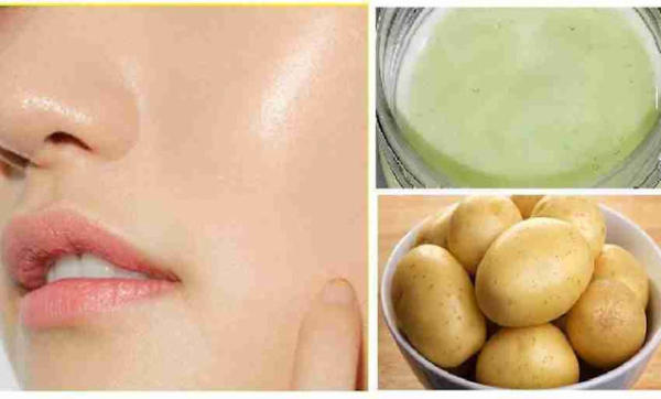 Vài cách trị nám đơn giản nhưng vô cùng hiệu quả 16 Vài cách trị nám đơn giản nhưng vô cùng hiệu quả