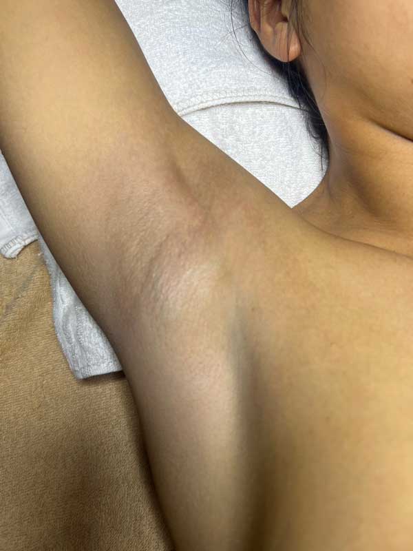 Tư vấn triệt lông hiệu quả an toàn tại Vy Spa quận 7 11 Tư vấn triệt lông hiệu quả an toàn tại Vy Spa quận 7
