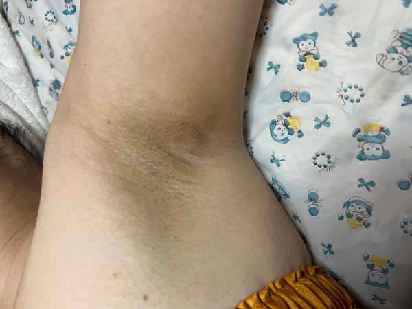Tư vấn triệt lông hiệu quả an toàn tại Vy Spa quận 7 4 Tư vấn triệt lông hiệu quả an toàn tại Vy Spa quận 7