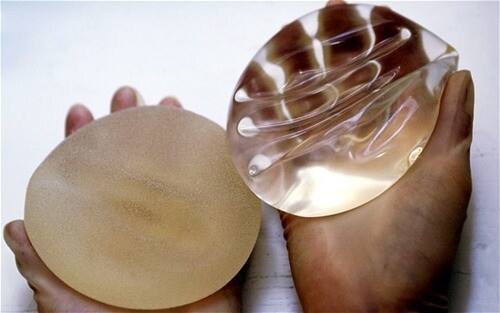 nâng ngục đẹp với chúng tôi